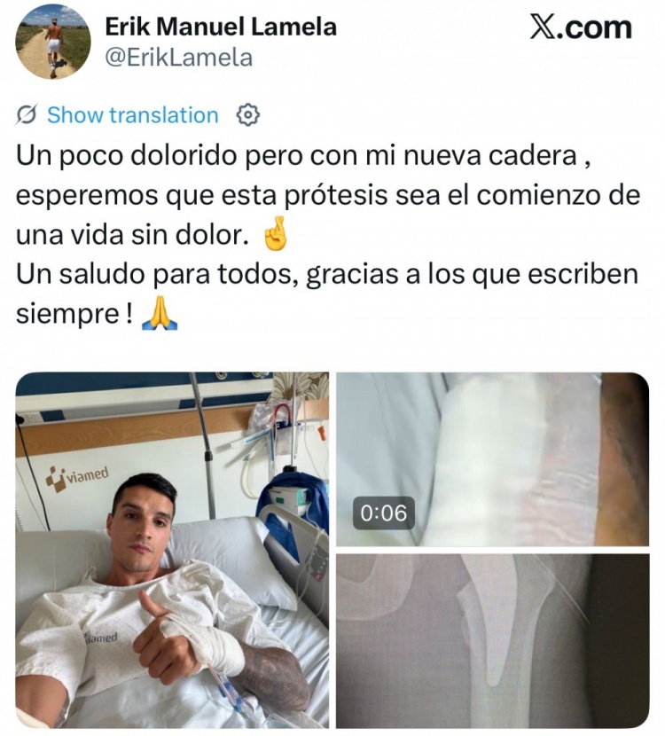 前热刺前锋拉梅拉接受髋关节置换术：22岁开始疼痛，5年靠止痛药撑比赛